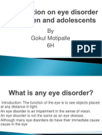 Eye Disorder in Children and Adolescents