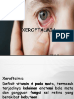 Xeroftalmia