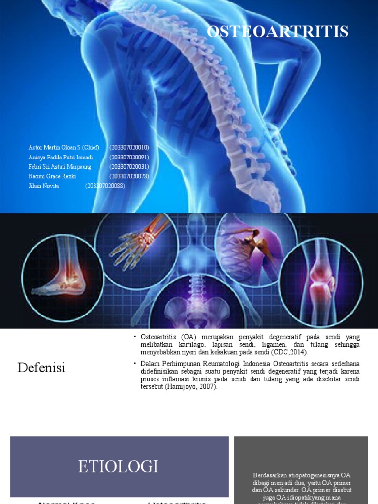 Osteoartritis Pdf