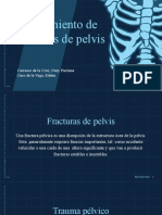 Fracturas de Pelvis