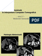 CT LP Abdomen