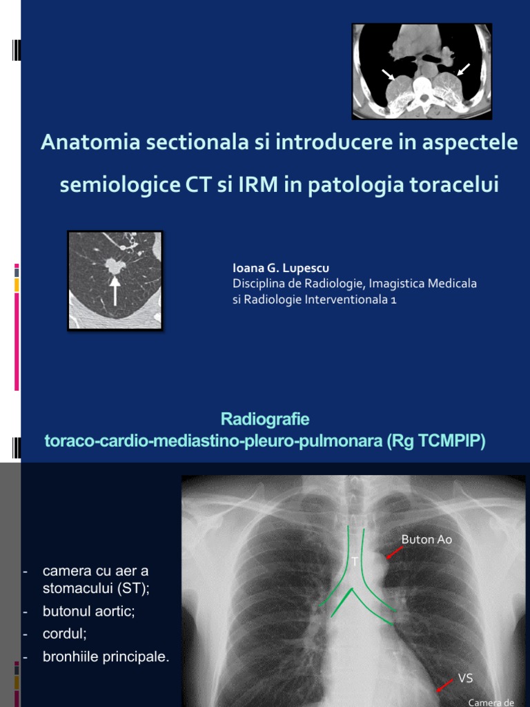 Torace | PDF