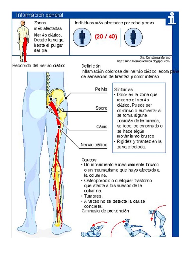 Recorrido Nervio Ciatico PDF