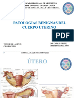 Pólipos y Miomatosis Uterina