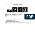 Radiologi CT Scan