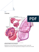 Emphysema: Symptoms & Causes Diagnosis & Treatment Doctors & Departments Print