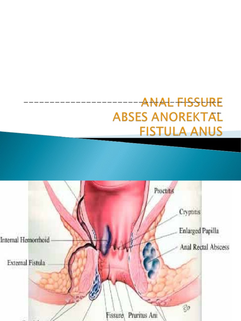 Tixomirovaning Sevgi striptizi