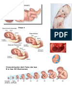 NEONATO