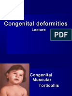 Congenital Deformities