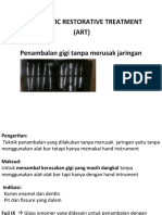 Penambalan Gigi Tanpa Alat Bor (ART