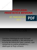 HIPERPLASIA PROSTATICA BENIGNA