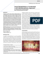 Esthetic and Functional Rehabilitation of Moderately Mutilated Dentition With Multidisciplinary Approach