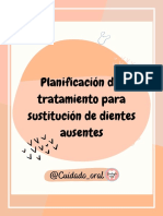 Planificación Del Tratamiento para Sustitución de Dientes Ausentes