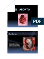 aborto