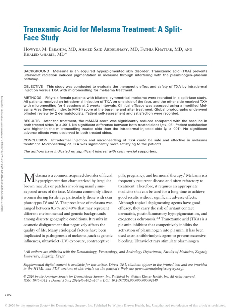 Tranexamic Acid For Melasma Treatment PDF Clinical Medicine