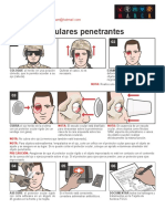 Lesiones Oculares