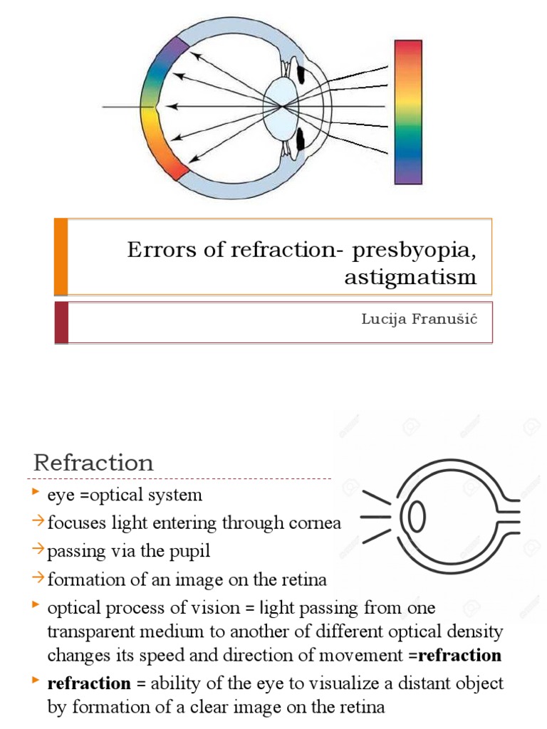 Errors of Refraction Presbyopia, Astigmatism PDF Contact Lens