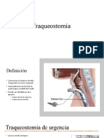 Traqueostomia y Toracotomia Minima