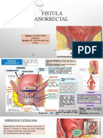 Fistula Anorrectal Ciru