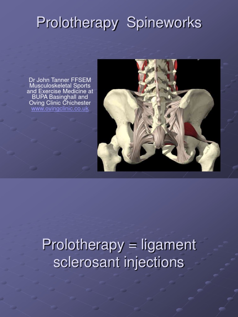 Spineworks Conference 2016 Prolotherapy | PDF | Pain | Physical Therapy