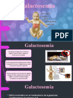 Galactosemia