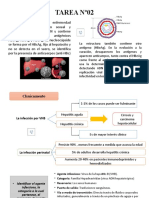 TAREA Nº02-Expo10