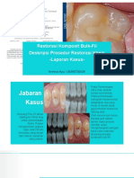 Restorasi Karies Premolar Atas Dengan Teknik Bulk-Fill