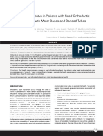 Oral Health Impacts of Molar Bands vs Bonded Tubes