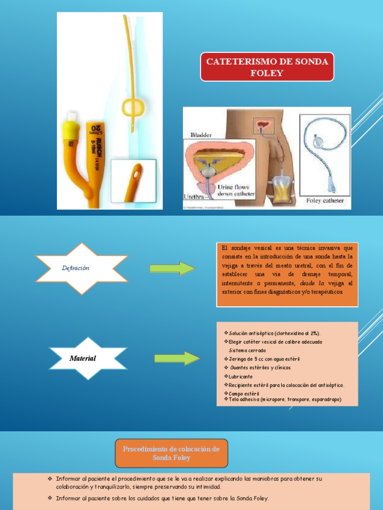 Procedimiento de Colocación Sonda Foley | PDF | Vejiga urinaria