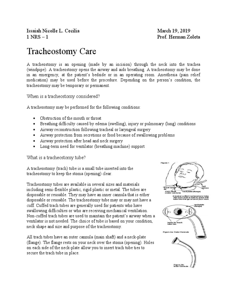 Tracheostomy Care A Comprehensive Guide to Tracheostomy Tube Management and Suctioning PDF
