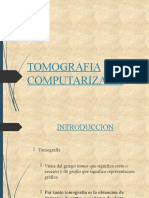 Tomografía Computada