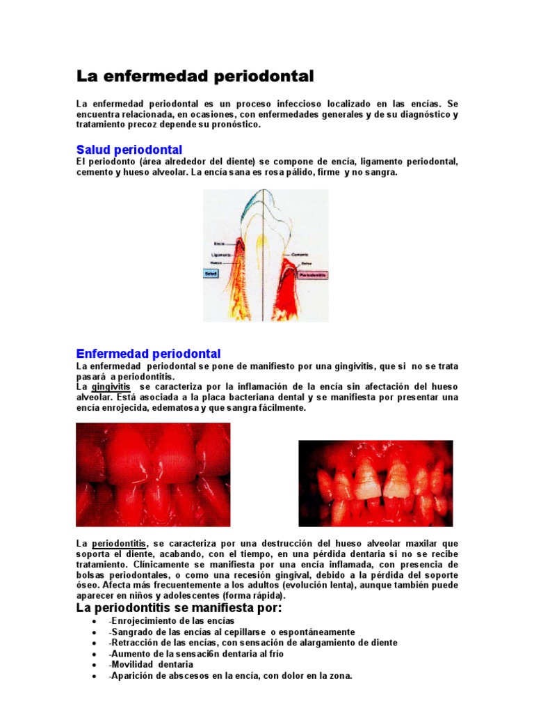 Enfermedad Periodontal | PDF