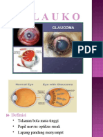Glaukoma-563 Dcfa 677 FD 0