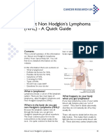 About Non Hodgkin's Lymphoma (NHL) - A Quick Guide