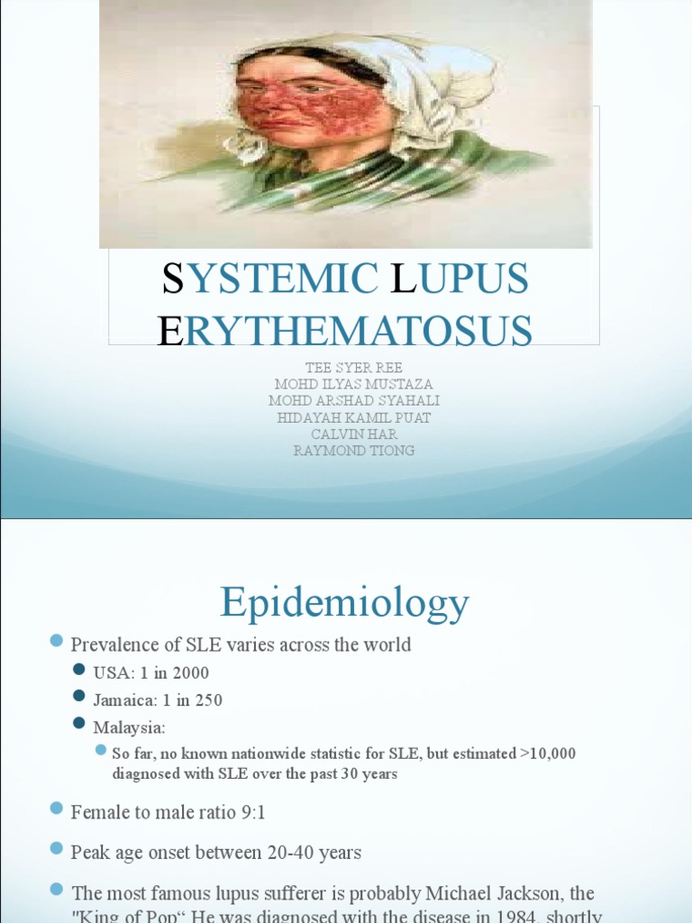SLE-combined 2 Arshad | PDF | Medical Specialties | Diseases And Disorders