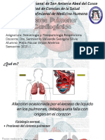 Edema Pulmonar Cardiogénico