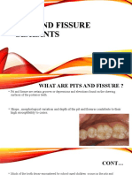 Pits and fissure sealants[2708]