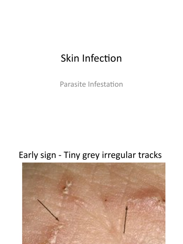 Skin Infection - Scabies | PDF | Diseases And Disorders | Medical ...