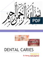 Dental Caries DR - Hanna