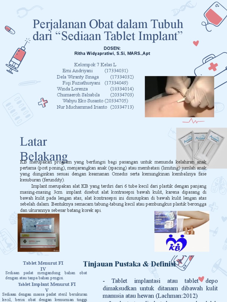 Tablet Implant Kel 7 Fix PDF