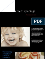What Is Teeth Spacing?: - Its Causes and Cures