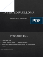 Inverted Papiloma