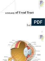 Diseases of Uveal Tract