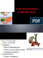 Case Presentation Gallstone Ileus