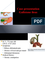 Gallstone Ileus final