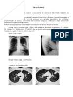 Dor torácica e hemoptise: possível câncer pulmonar