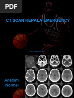 Download CT Scan Kepala Emergency by VictorJansen SN51137104 doc pdf