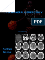 CT Scan Kepala Emergency