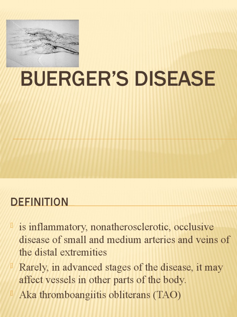 Buerger's Disease PDF Medicine Epidemiology