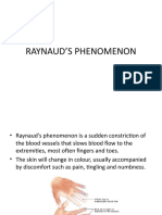 Raynaud's Phenomenon